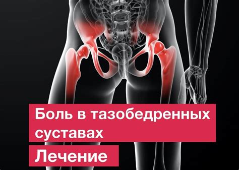 Боль в коленном и тазобедренном сустава - причины и лечение